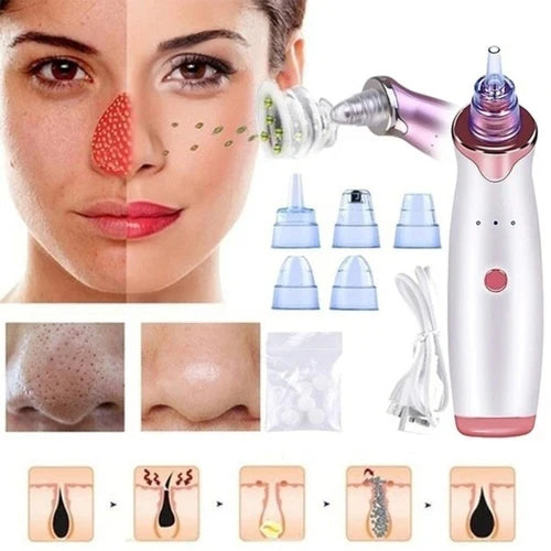 Multi-Functional Blackhead Whitehead Remover