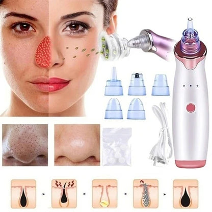 Multi-Functional Blackhead Whitehead Remover