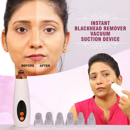 Multi-Functional Blackhead Whitehead Remover